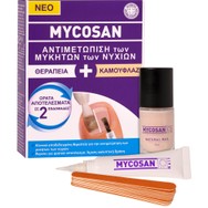 Mycosan Fungal Nail Treatment + Camouflage Kit Θεραπευτικό Κιτ για την Αντιμετώπιση των Μυκήτων των Νυχιών του Ποδιού με Ειδικό Καλυπτικό Βερνίκι 1 Τεμάχιο