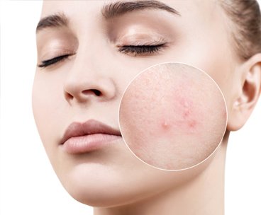 &Alpha;&nu;&tau;&eta;&lambda;&iota;&alpha;&kappa;ά &Pi;&rho;&omicron;&sigma;ώ&pi;&omicron;&upsilon; &gamma;&iota;&alpha; &Alpha;&kappa;&mu;ή & &Lambda;&iota;&pi;&alpha;&rho;ό&tau;&eta;&tau;&alpha;&nbsp;