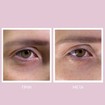 Youth Lab Peptides Spring Hydra-Gel Eye Συσφιγκτική & Αντιρυτιδική Μάσκα για την Περιοχή των Ματιών 60Patches Youth Lab Peptides Spring Hydra-Gel Eye Συσφιγκτική & Αντιρυτιδική Μάσκα για την Περιοχή των Ματιών 60Patches
