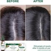 Klorane Promo Quinine & Keratin Strength + Vitality Hair & Nails 90caps (3x30caps)