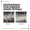 Vichy Dercos Anti-Dandruff DS Shampoo for Dry Hair 300ml & Δώρο 100ml