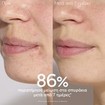 Caudalie Vinopure Blemish Control Salicylic Serum 30ml Caudalie Vinopure Blemish Control Salicylic Serum 30ml