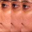 Caudalie Vinopure Blemish Control Salicylic Serum 30ml Caudalie Vinopure Blemish Control Salicylic Serum 30ml