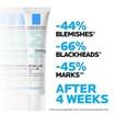 La Roche-Posay Promo Effaclar Duo + M 40ml & Δώρο Purifying Foaming Gel 50ml & Δώρο Anthelios UVMune Spf50+ 400 Oil Control Fluid 3ml