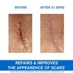Uriage Bariederm Cica Cream with Copper-Zinc 100ml Uriage Bariederm Cica Cream with Copper-Zinc 100ml