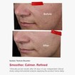 Skincode Essentials Azelaic Texture Booster 30ml