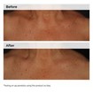 The Ordinary Niacinamide 5% Face & Body Emulsion 100ml The Ordinary Niacinamide 5% Face & Body Emulsion 100ml