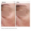 The Ordinary Niacinamide 5% Face & Body Emulsion 100ml The Ordinary Niacinamide 5% Face & Body Emulsion 100ml