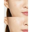 COSRX Master Patch Original Fit Anti-Imprefection Face Patches 24 Τεμάχια COSRX Master Patch Original Fit Anti-Imprefection Face Patches 24 Τεμάχια