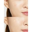COSRX Master Patch Original Fit Anti-Imprefection Face Patches 24 Τεμάχια