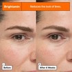 Dr.Jart+ Brightamin Brightening Serum Ampoule 1 Τεμάχιο Dr.Jart+ Brightamin Brightening Serum Ampoule 1 Τεμάχιο