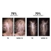 Vichy Dercos Aminexil Clinical R.E.G.E.N. Booster for Hair Loss 90ml