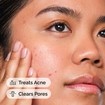 The Ordinary Salicylic Acid 2% Solution Face Serum 30ml The Ordinary Salicylic Acid 2% Solution Face Serum 30ml
