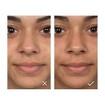 Caudalie Vinopure Blemish Control Infusion Serum 30ml Caudalie Vinopure Blemish Control Infusion Serum 30ml