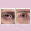 Youth Lab Peptides Spring Hydra-Gel Eye Patches Συσφιγκτικό & Αντιρυτιδικό Patch για την Περιοχή των Ματιών 1 Pair