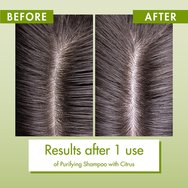Klorane Citrus Shampoo Normal to Oily Hair 400ml